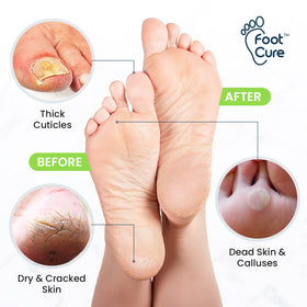 FOOT CURE Tea Tree Foot Soak ingredients close-up highlighting natural oils
