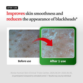 FORETDERM gentle exfoliating cleanser designed for sensitive skin with mild exfoliation