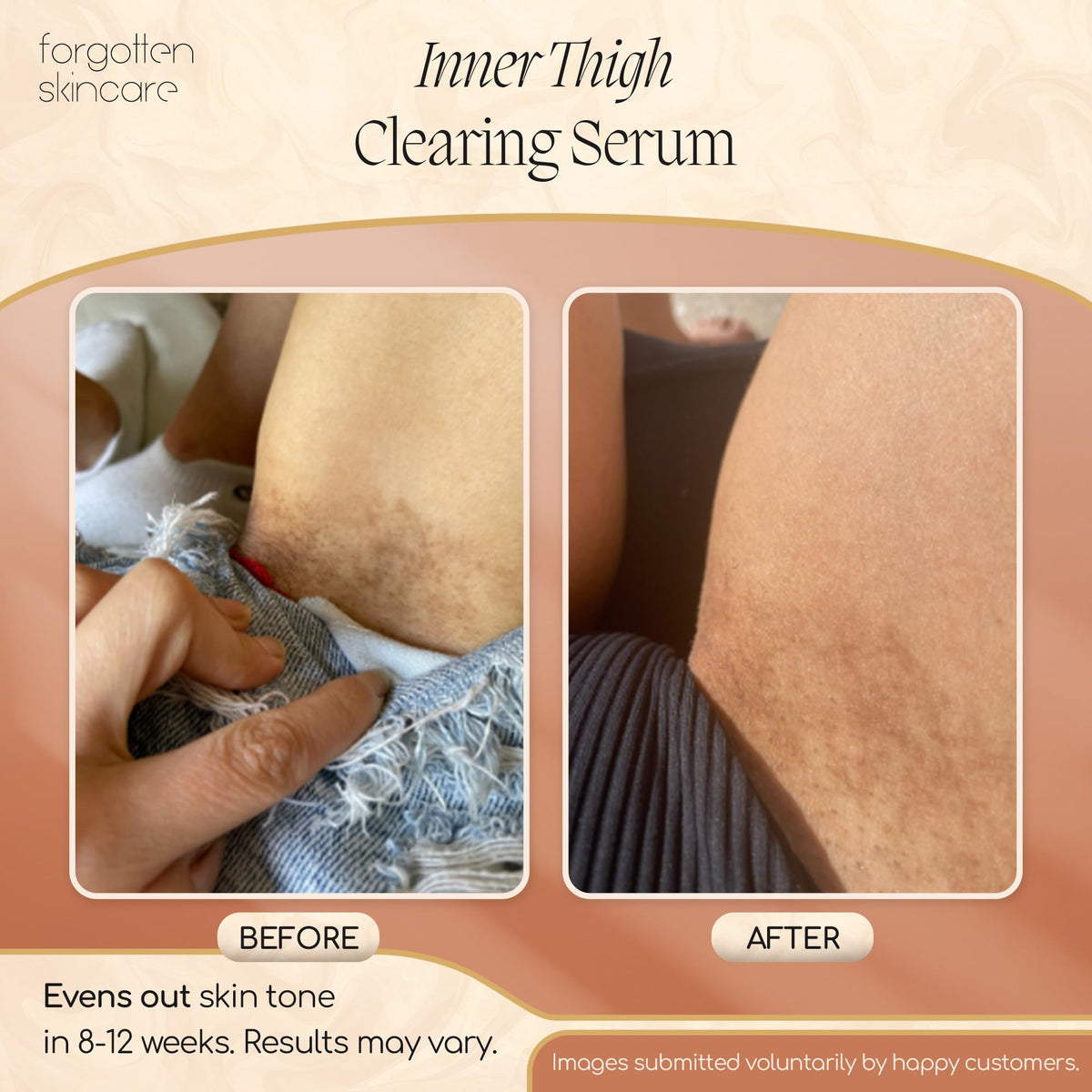 Forgotten Skincare Body Oil Serum being applied on intimate skin for comfort