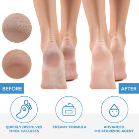 ForPro Professional Collection 32 oz packaging ready for salon or home.