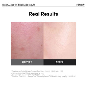 FRANKLY Niacinamide beads close-up illustrating bead-to-skin delivery