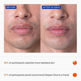 Freaks of Nature Deeper Dive Serum dermatologist-tested label, gentle for sensitive skin.