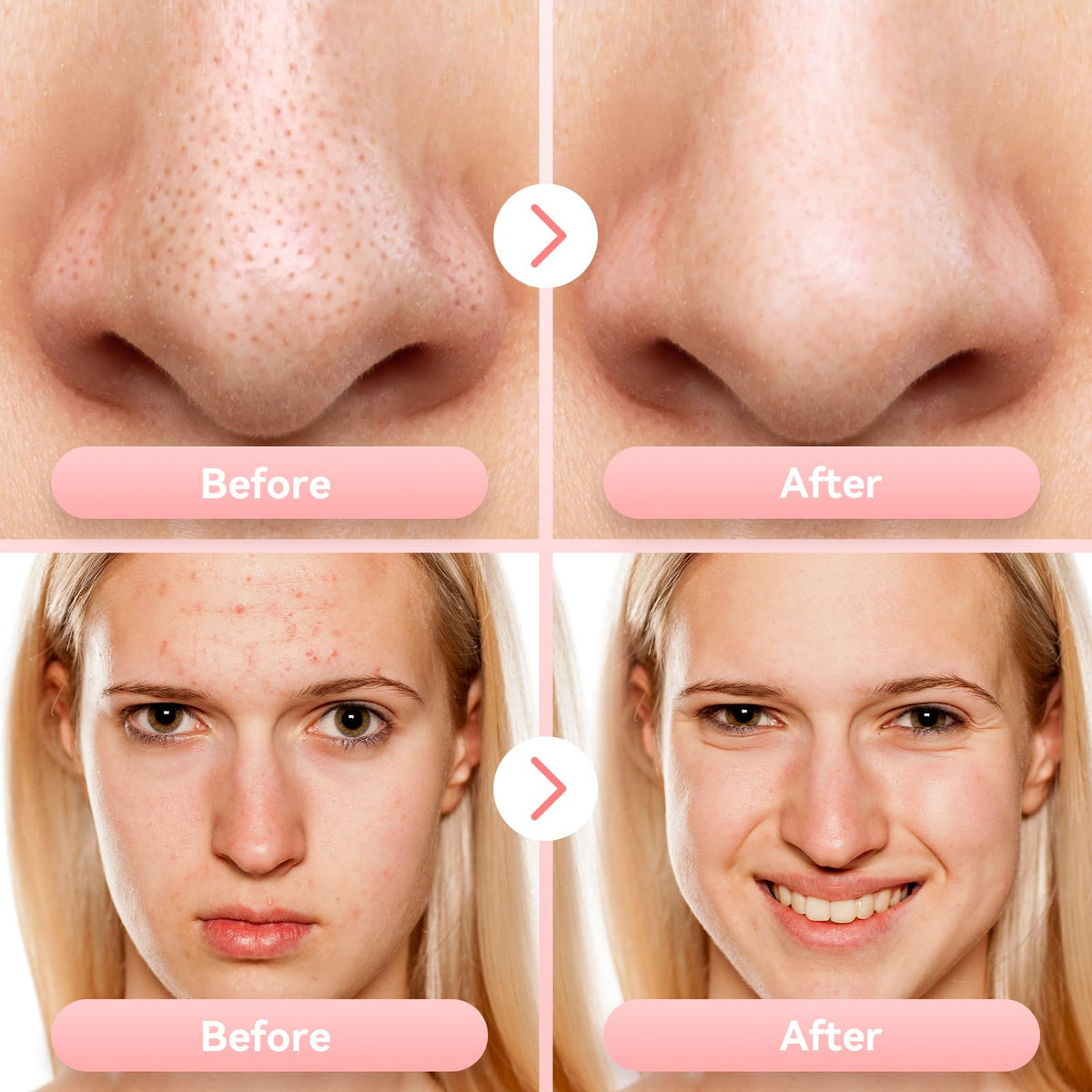FREESHOW ABS housing ensures skin-safe contact.