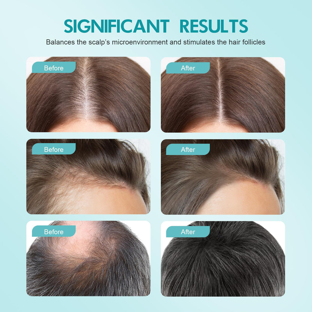 Fugit minoxidil bottle and label featuring rosemary and biotin.