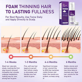 Fugit minoxidil foam women foamy texture close-up highlights light, creamy consistency.