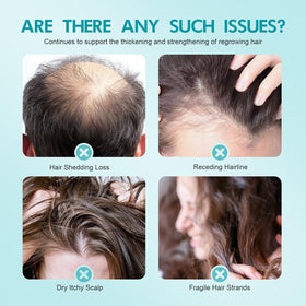 Fugit minoxidil scalp massage cream ready for 2-3 times weekly use.