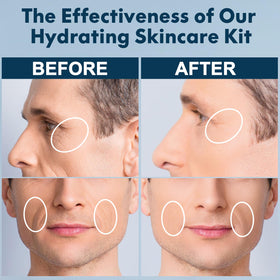 FullLight Tech eye cream 20ml tube signals targeted eye-area care.