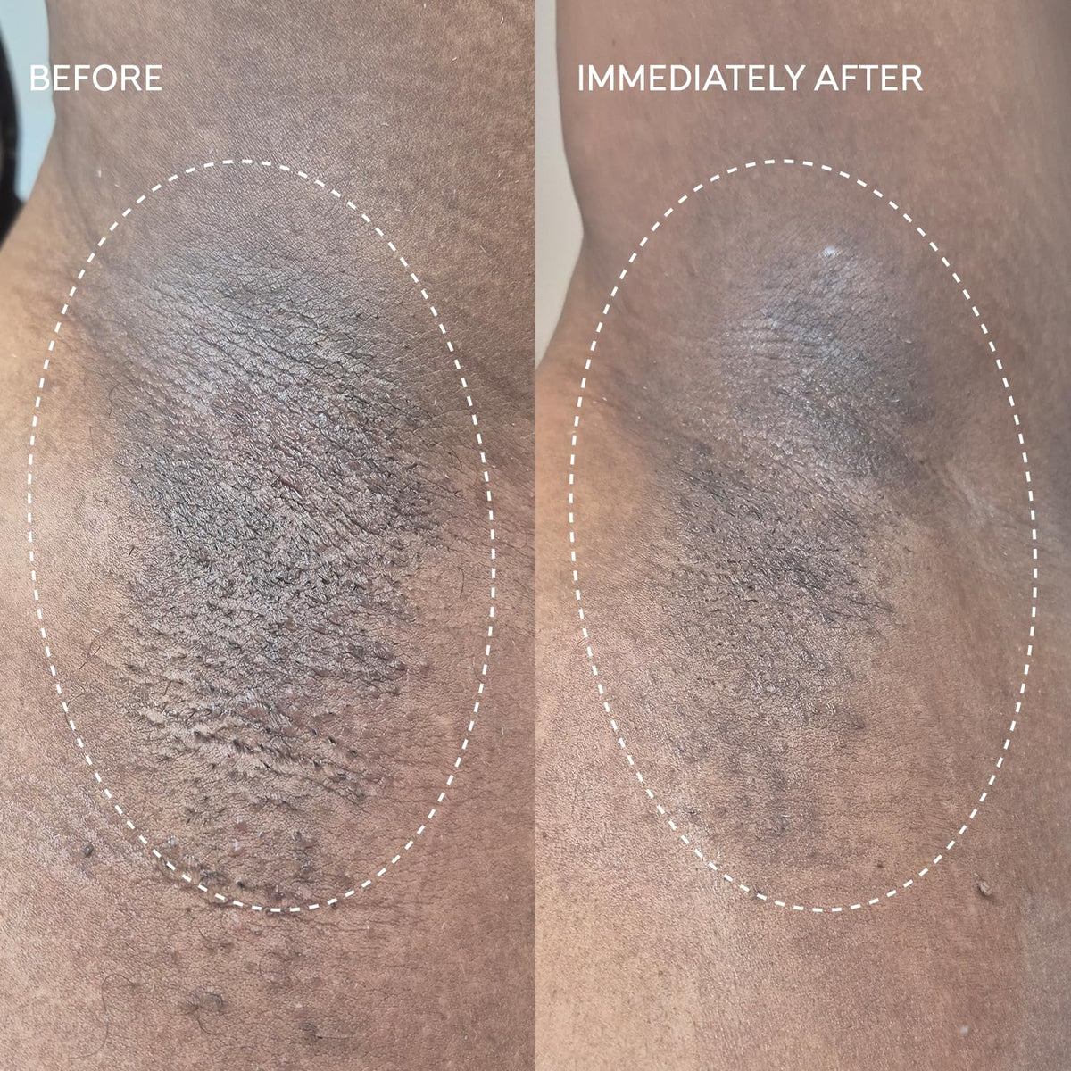 Application on skin after shaving reveals quick cooling and soothing effect.
