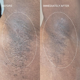 Application on skin after shaving reveals quick cooling and soothing effect.