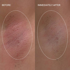 Underarm area shown being treated with Fur Flash Repair Gel.