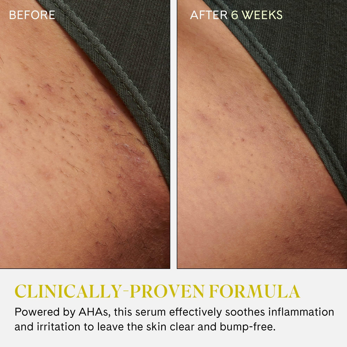 Skin texture close-up after use shows smoother appearance.