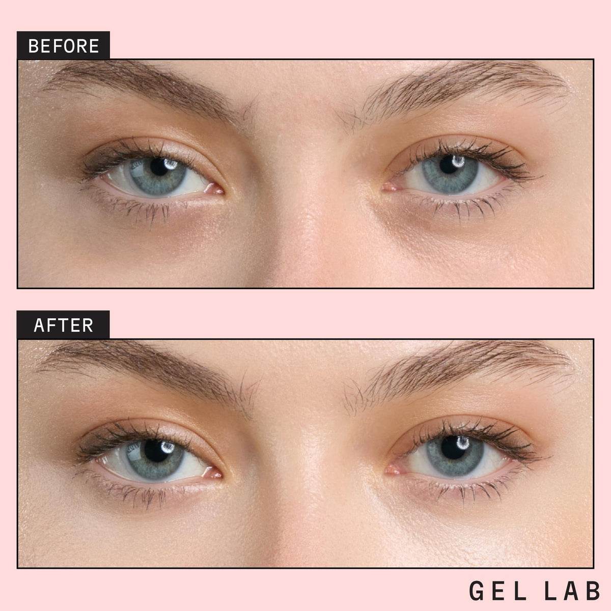 Gel Lab RENEW eye patch sits on skin, delivering soothing hydration.