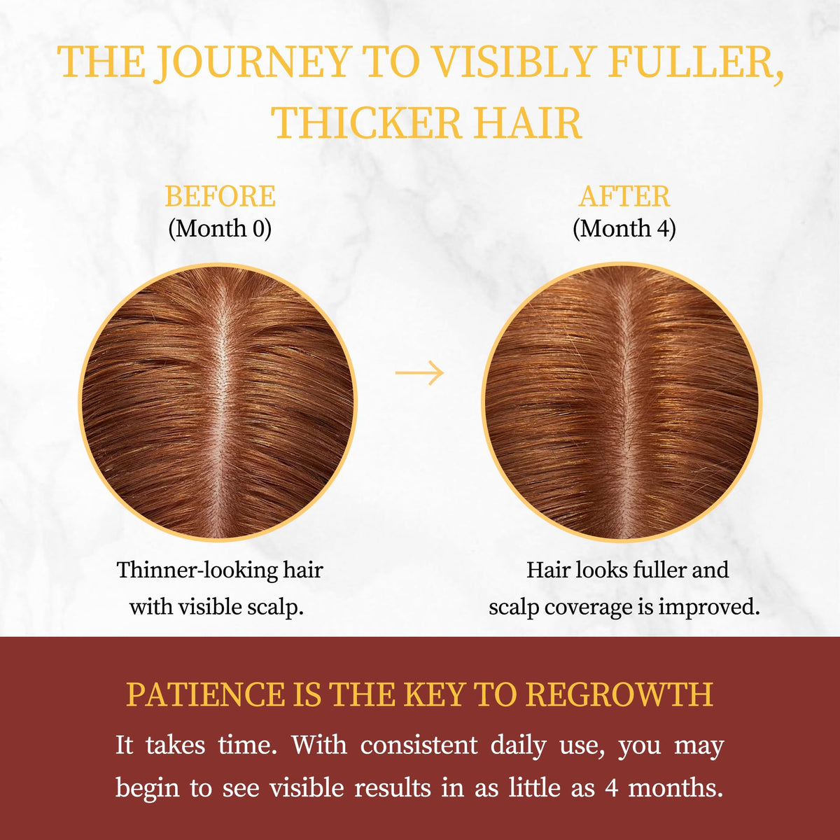 Gemächlich Zu Hause Minoxidil rosemary extract indicates scalp nourishment with natural rosemary.