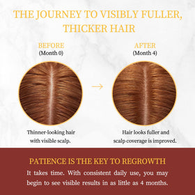 Gemächlich Zu Hause Minoxidil rosemary extract indicates scalp nourishment with natural rosemary.
