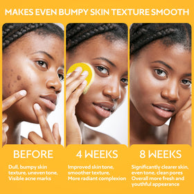 GEMSKIN ingredients aloe vera turmeric kojic acid for soothing cleansing.