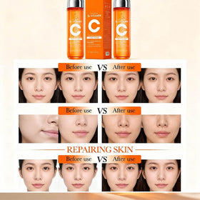 Generic 5x Vitamin C Toner texture closeup: lightweight, non-greasy hydration on skin.