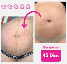 ADEUS Original Intensive Skin Treatment cream texture supports easy spreading and absorption