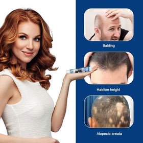 Generic Alopecia Hair Growth Cream quick absorption closeup on scalp