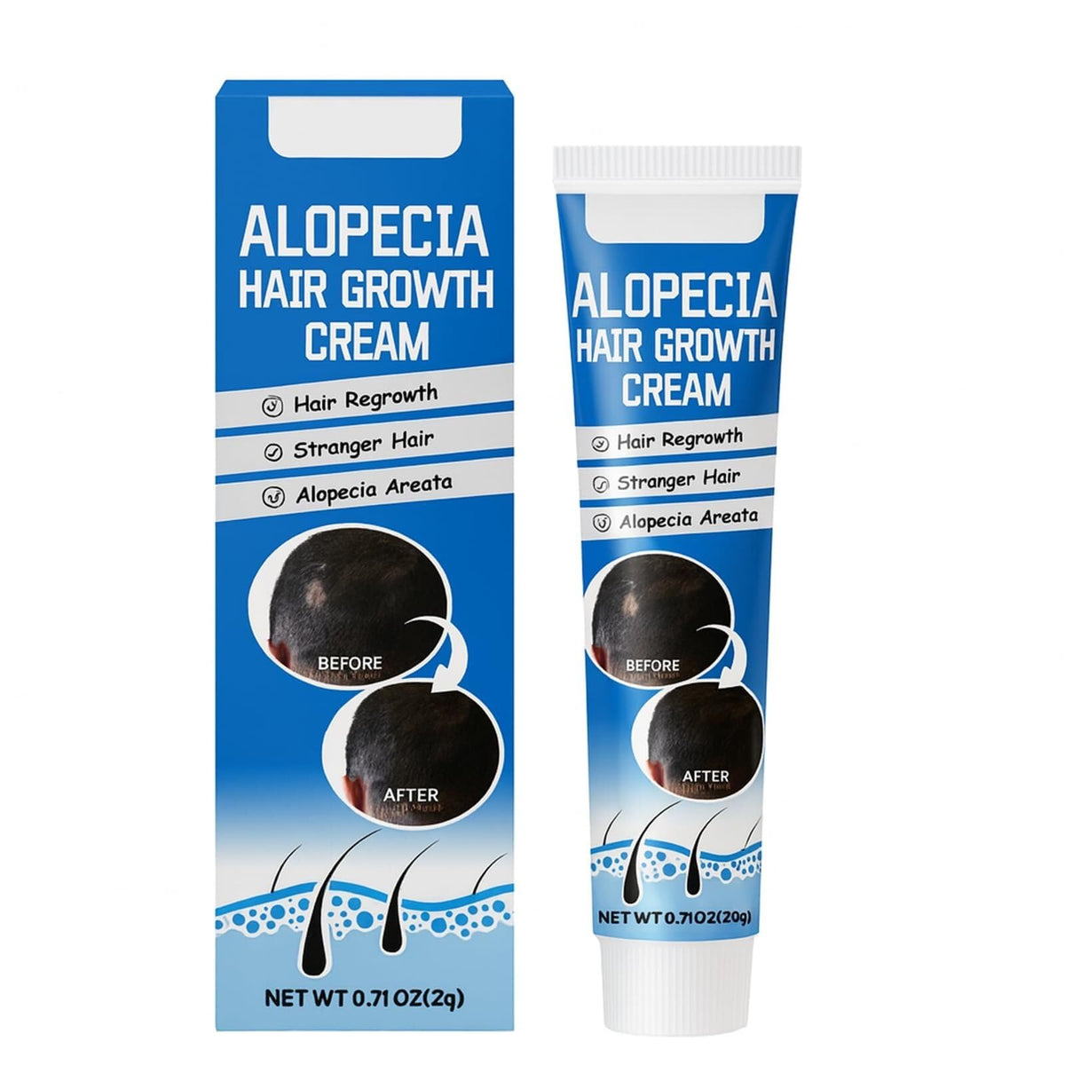 Generic Alopecia Hair Growth Cream bottle packaging for daily scalp care