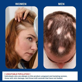 Generic Alopecia Hair Growth Cream closeup highlights creamy texture