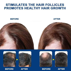 Generic Alopecia Hair Growth Cream daily-use bottle ready for routines