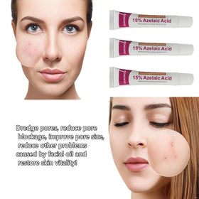 Packaging of Generic Azelaic Acid Cream ideal for daily skincare routines.