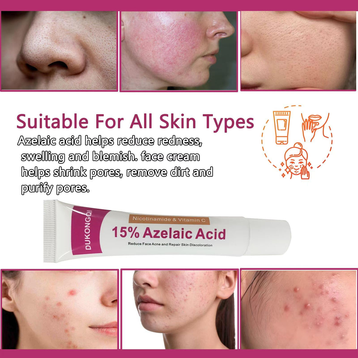 Generic Azelaic Acid Serum dropper ready for precise application