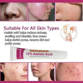 Generic Azelaic Acid Serum dropper ready for precise application
