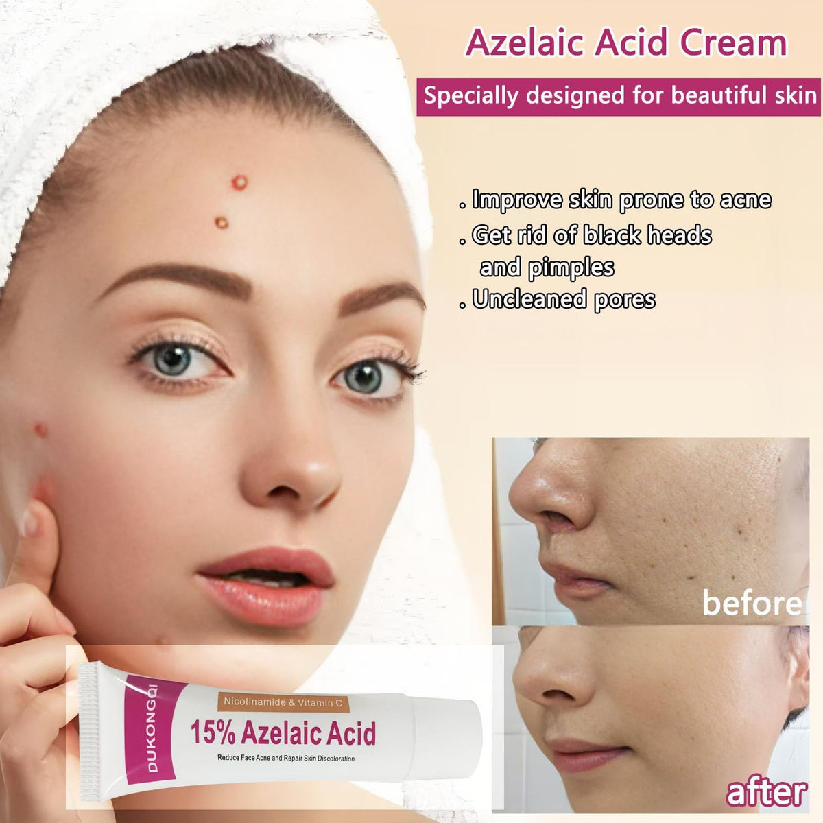 Generic Azelaic Acid Serum texture close-up reveals silky lightweight formula
