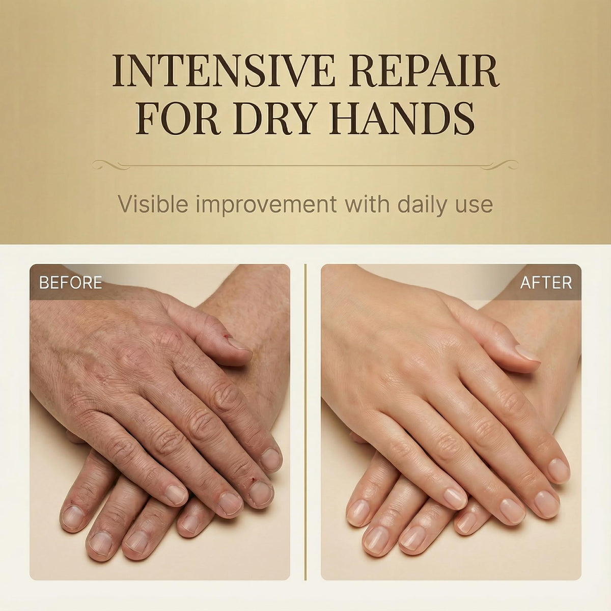 Hands applying Generic Collagen Hand Cream for smooth, hydrated skin.