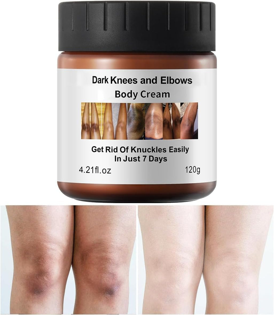 Generic Dark Knees Remover bottle close-up highlighting hydrating formula for dark areas.
