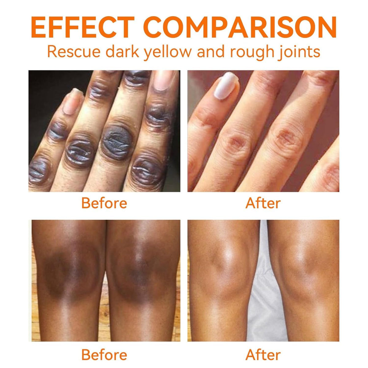 Generic Dark Knees Remover applied to elbow area for targeted hydration.