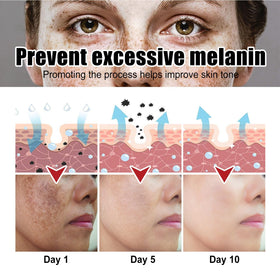 Elbows and knees treated with Generic Dark Spot Cream for even tone