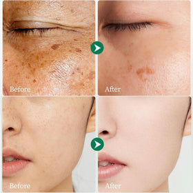 Underarms treated with Generic Dark Spot Cream for gentle care