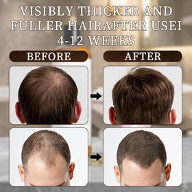 Excalvo Onion Shampoo being applied to hair with rich lather for easy use.