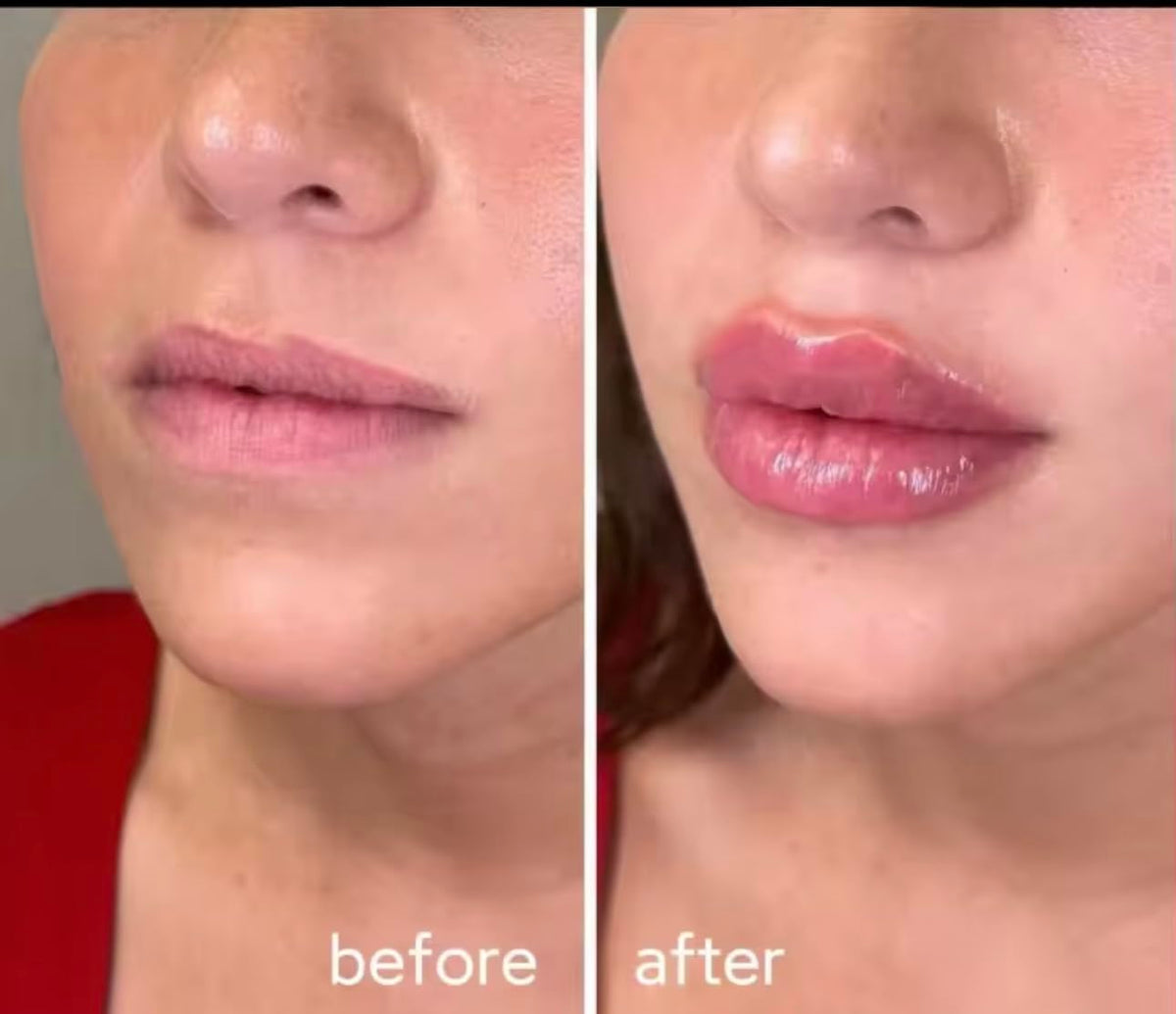 Generic Extreme Lip Plumping Gloss packaging and bottle shot highlighting hydrating ingredients