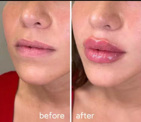 Generic Extreme Lip Plumping Gloss packaging and bottle shot highlighting hydrating ingredients