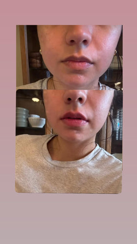 Generic Extreme Lip Plumping Gloss close-up shows tingling and shine