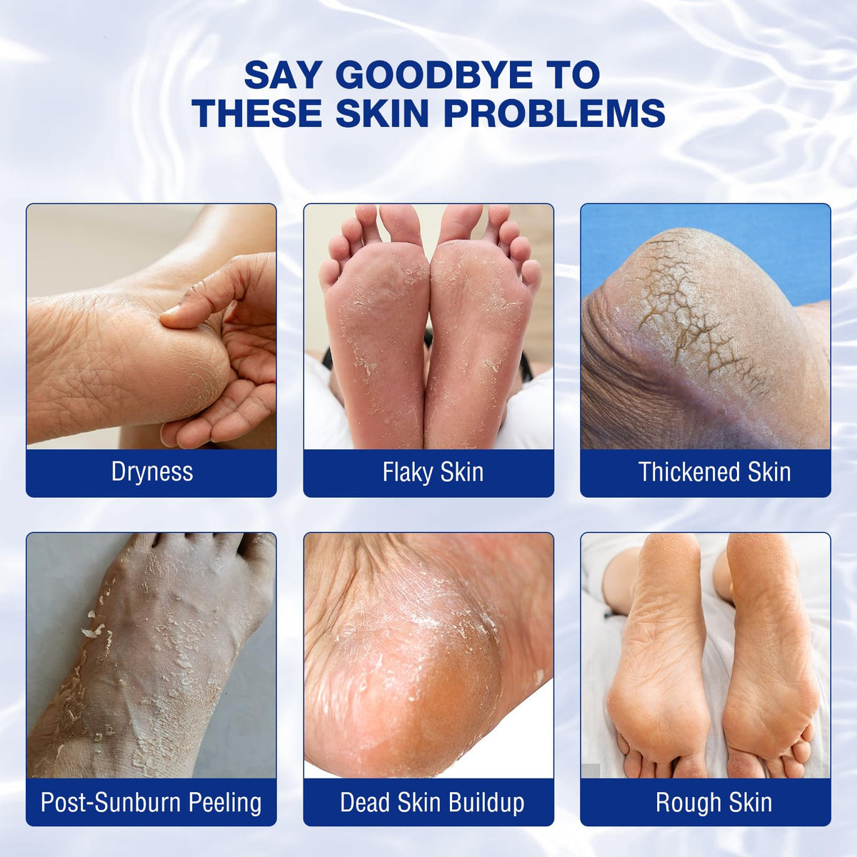 Generic Foot Cream application on feet illustrates fast, non-greasy absorption after use.