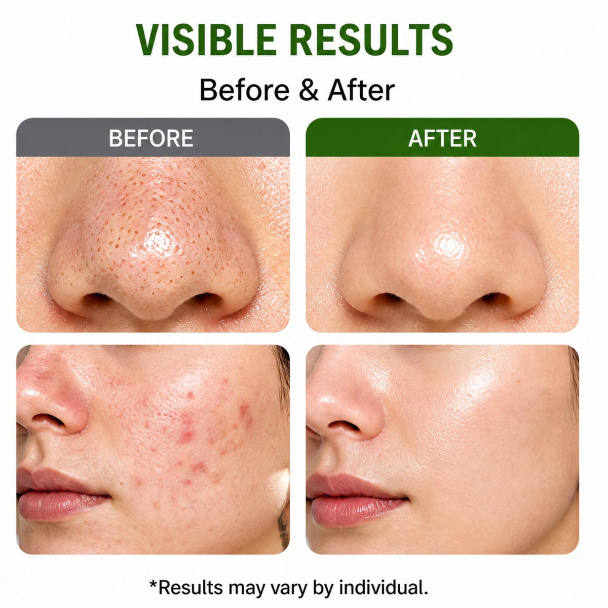 Generic Holy Basil Bubble Deep Mask hydrates with hyaluronic acid during cleansing.
