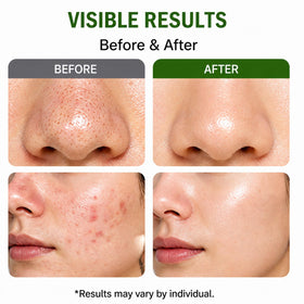 Generic Holy Basil Bubble Deep Mask hydrates with hyaluronic acid during cleansing.