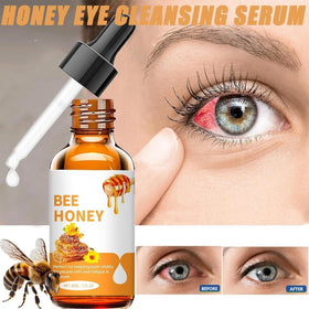 Generic Honey Eye Care drops in-use; provides instant hydration.