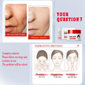 Generic Kojic Acid Cream with Hyaluronic Acid supports hydration for delicate skin.