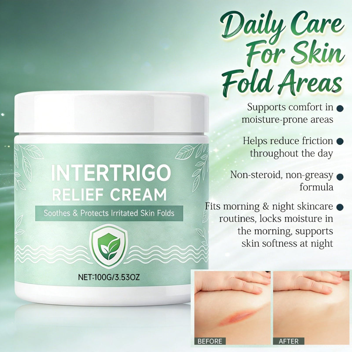Generic Intertrigo Cream friction reduction supports a smoother feel when moving throughout the day.