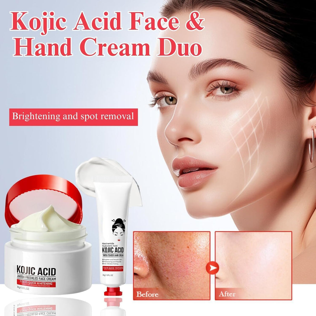 Generic Kojic Acid Cream application on hand demonstrates smooth, even coverage.