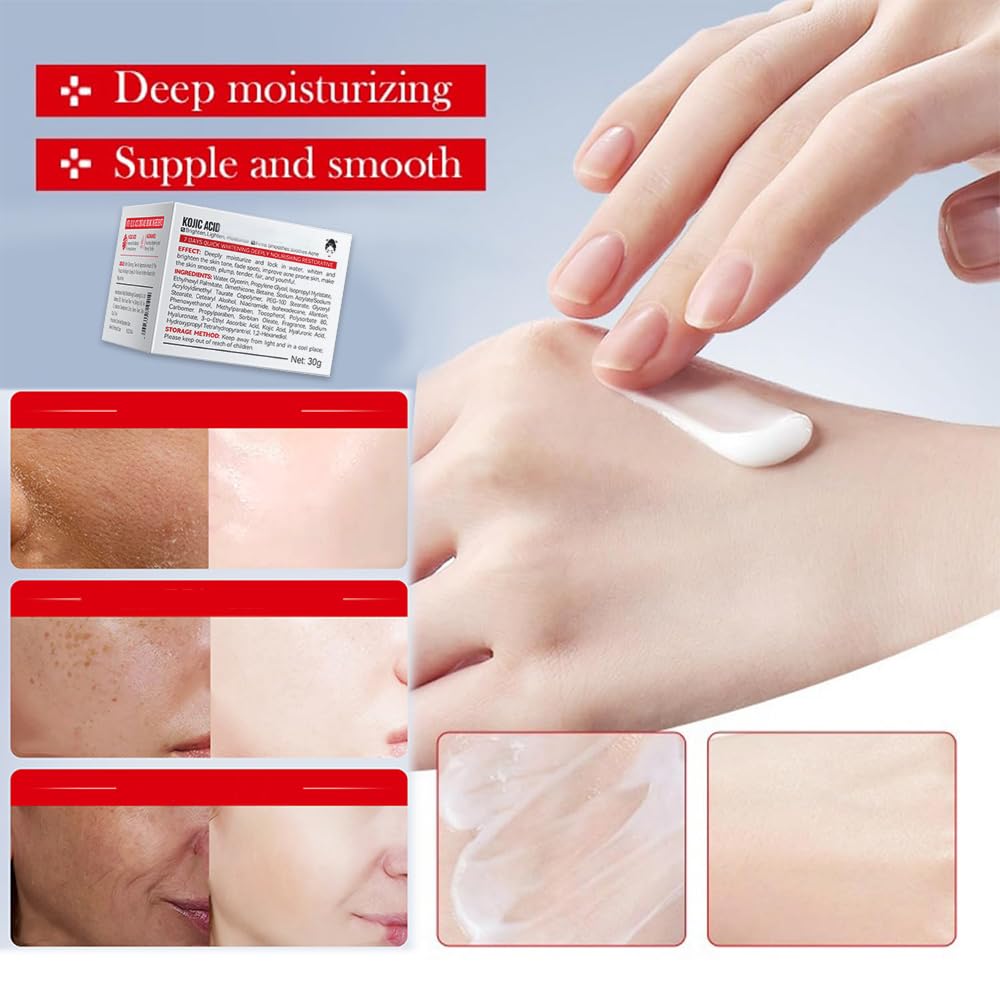 Generic Kojic Acid Cream on the face suggests a light daily routine.