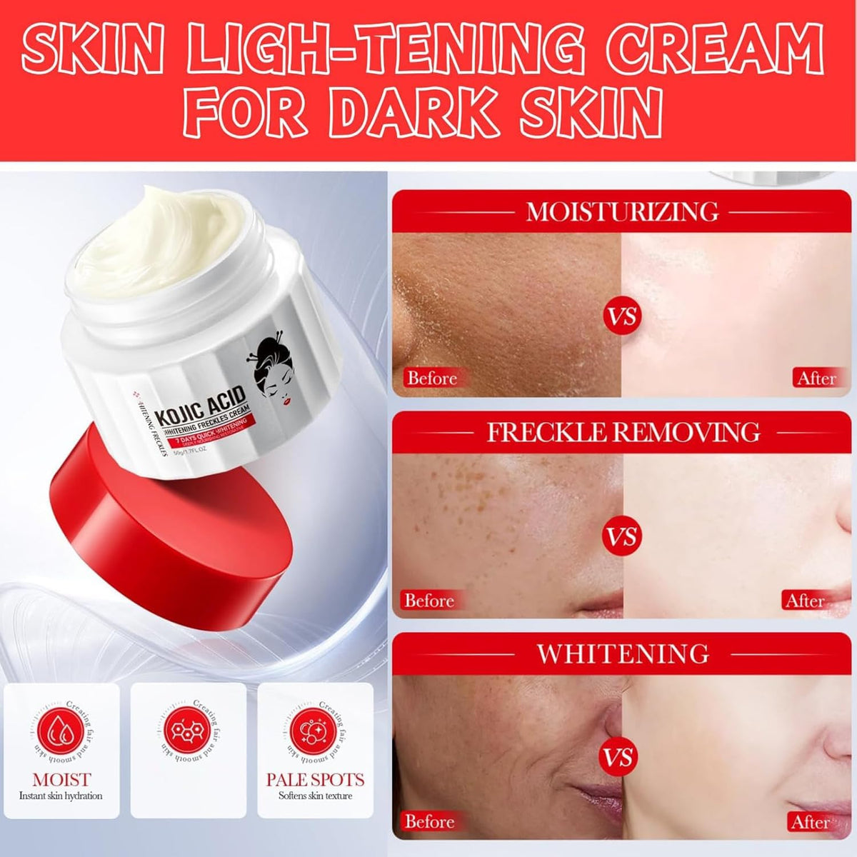 Generic Kojic Acid Cream label closeup highlights skin-friendly ingredients.