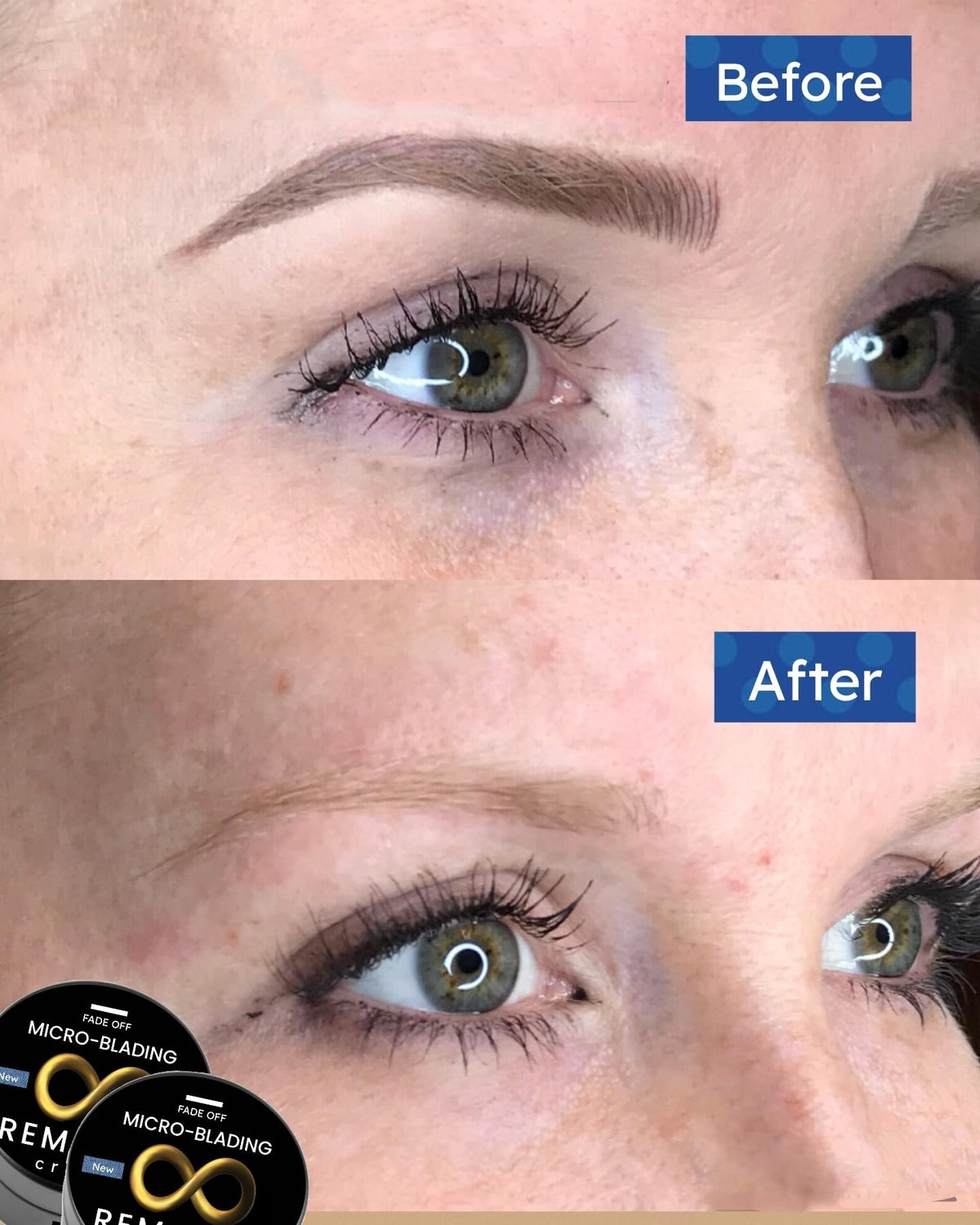 Generic Microblading Removal Cream applicator showing smooth topical use