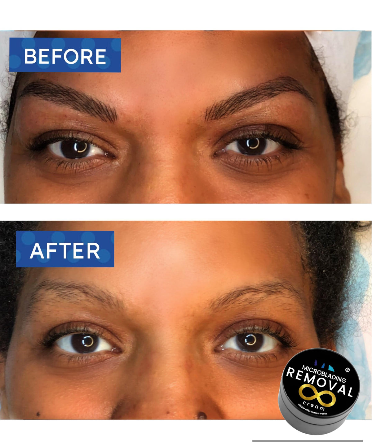 Generic Microblading Removal Cream texture close-up shows smooth application