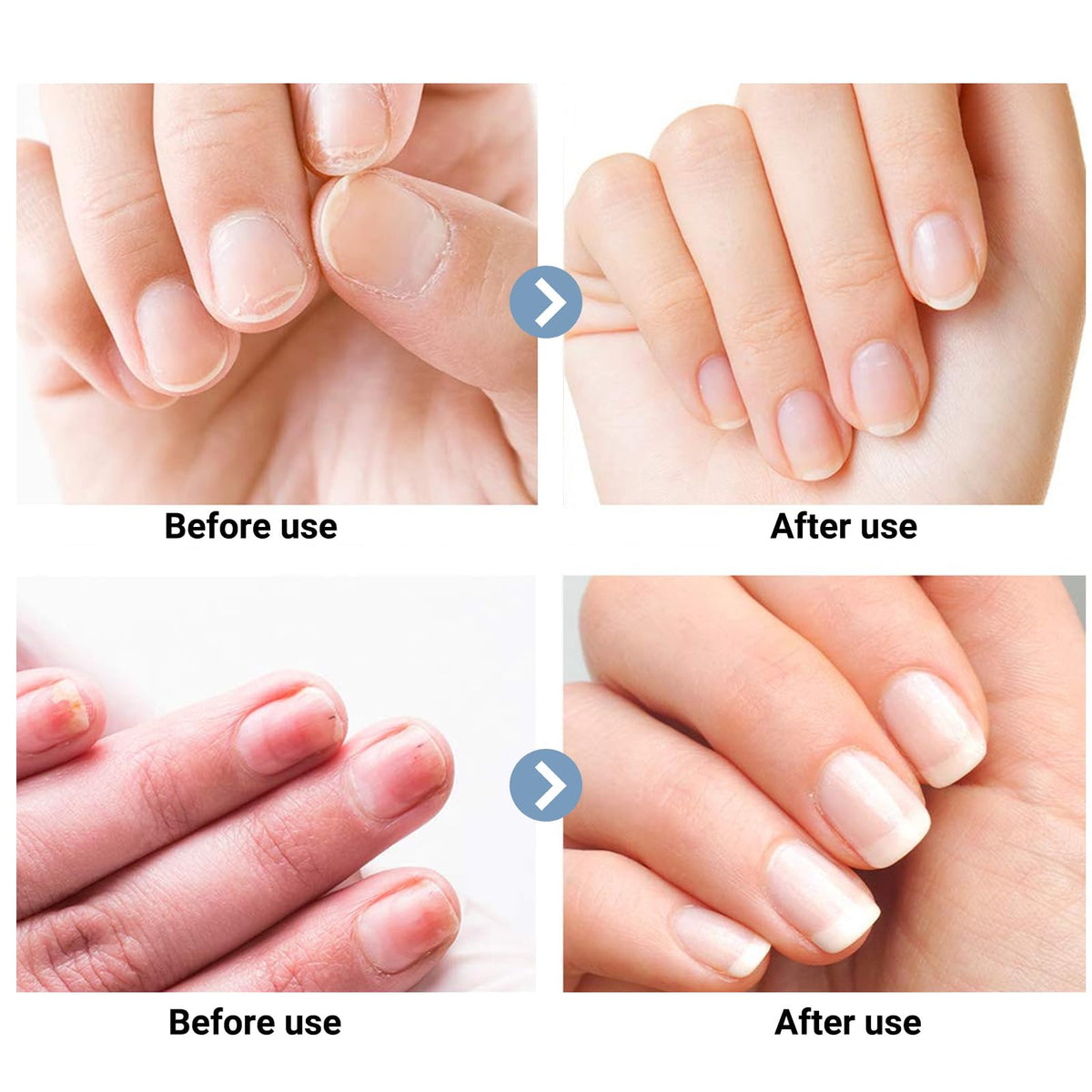 Generic Nail Clippers operate quietly, helping maintain a calm grooming session